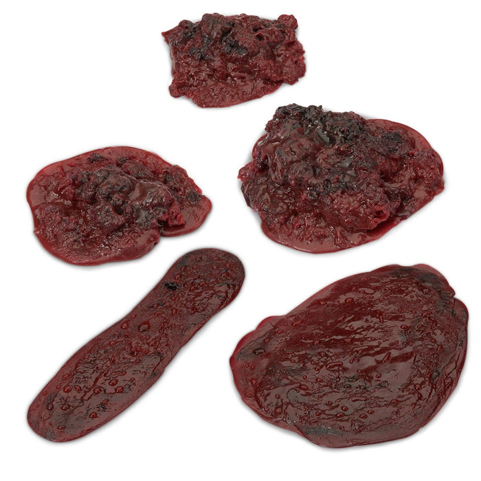 Simulated Blood Clots and Haemorrhages (Set of 5) LF00714 | Sim & Skills