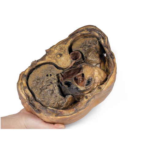 3D True-to-life Anatomy - Thorax and Heart