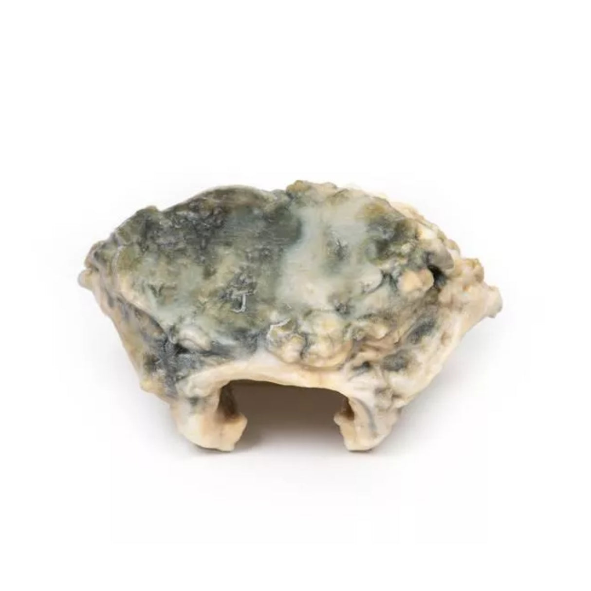 Carcinoma of Larynx| EZ-MP2052 | Sim & Skills Ltd