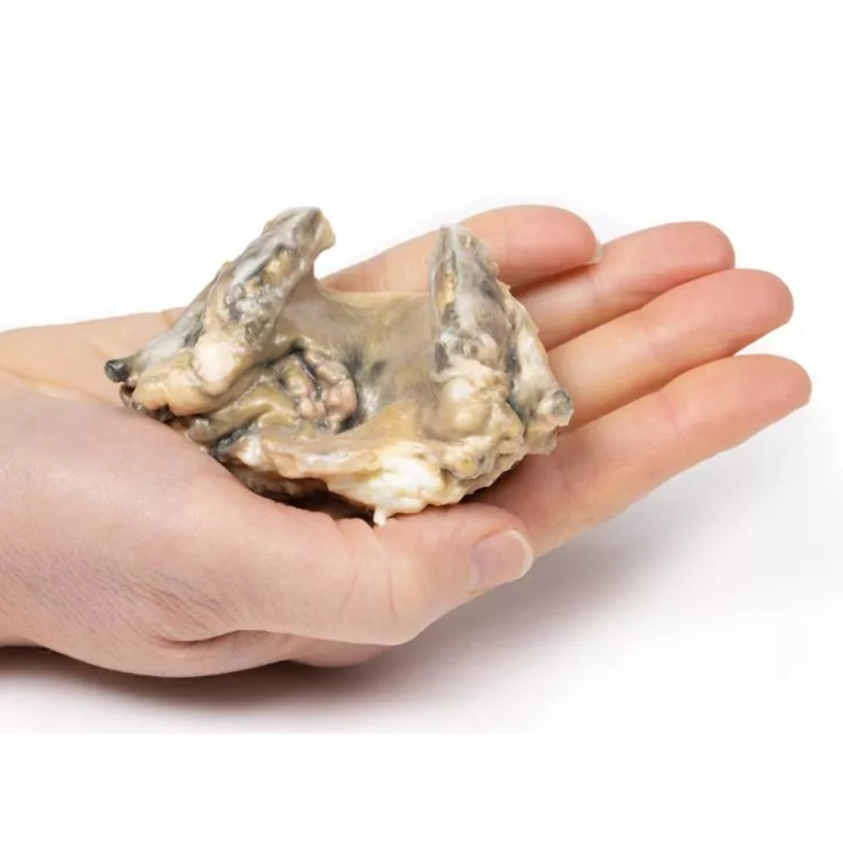 Carcinoma of Larynx| EZ-MP2052 | Sim & Skills Ltd