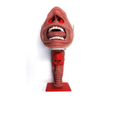 Angioedema Difficult Airway
