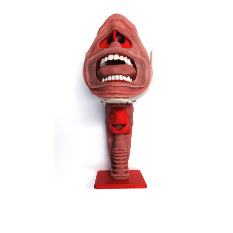 Angioedema Difficult Airway