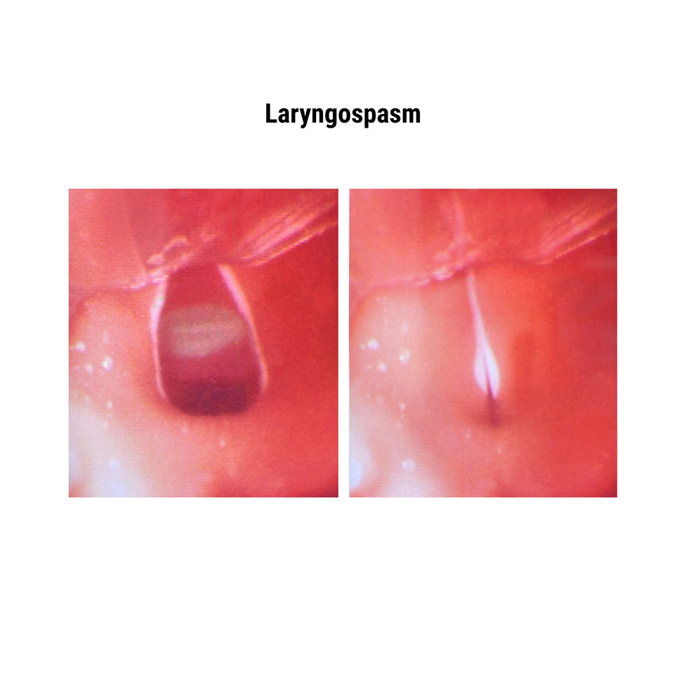 Difficult Airway Management Simulator with Feedback