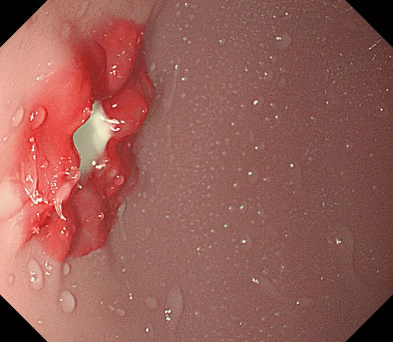OGD (OesophagoGastroDuodenoscopy) Simulator