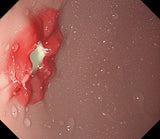 OGD (OesophagoGastroDuodenoscopy) Simulator