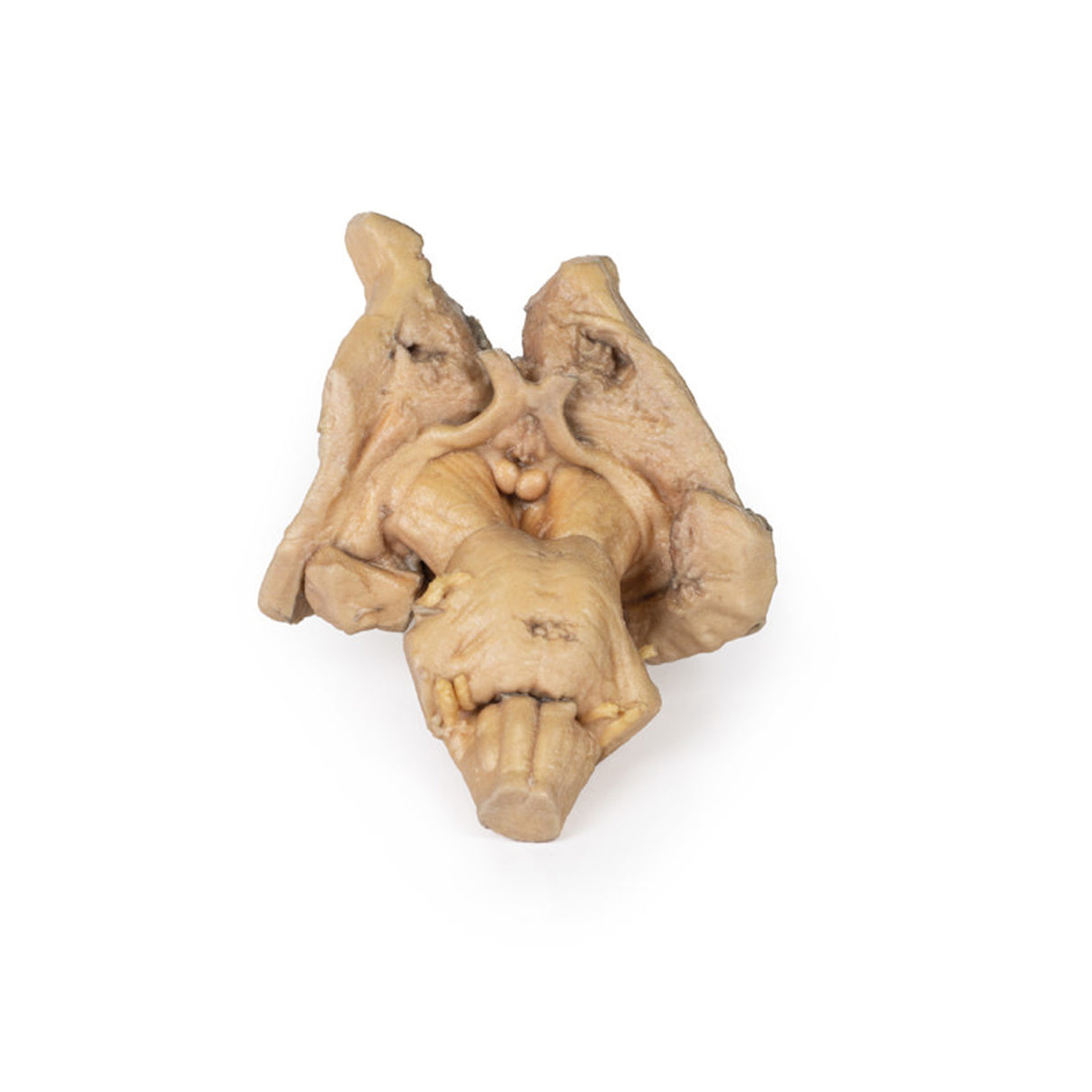 Brain stem, deep cerebral and diencephalic structures | EZ-MP1100 | Sim & Skills Ltd