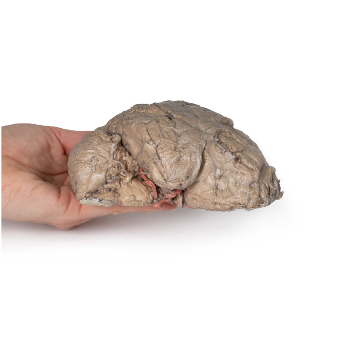 Brain Hemisection | EZ-MP1102 | Sim & Skills Ltd