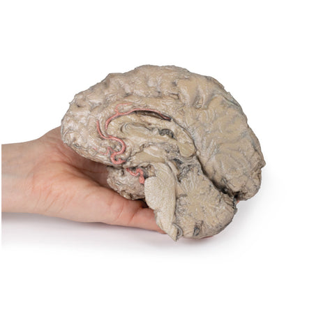 Brain Hemisection | EZ-MP1102 | Sim & Skills Ltd