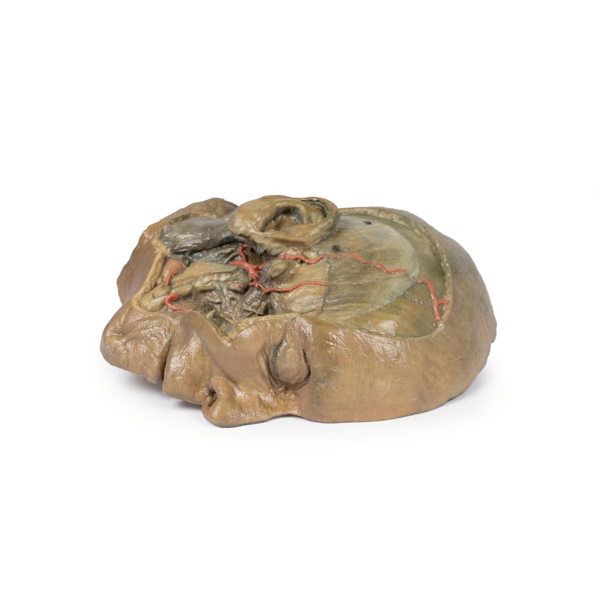 Sagittal Section of head with infratemporal Fossa Dissection | EZ-MP1104 | SIm & Skills Ltd
