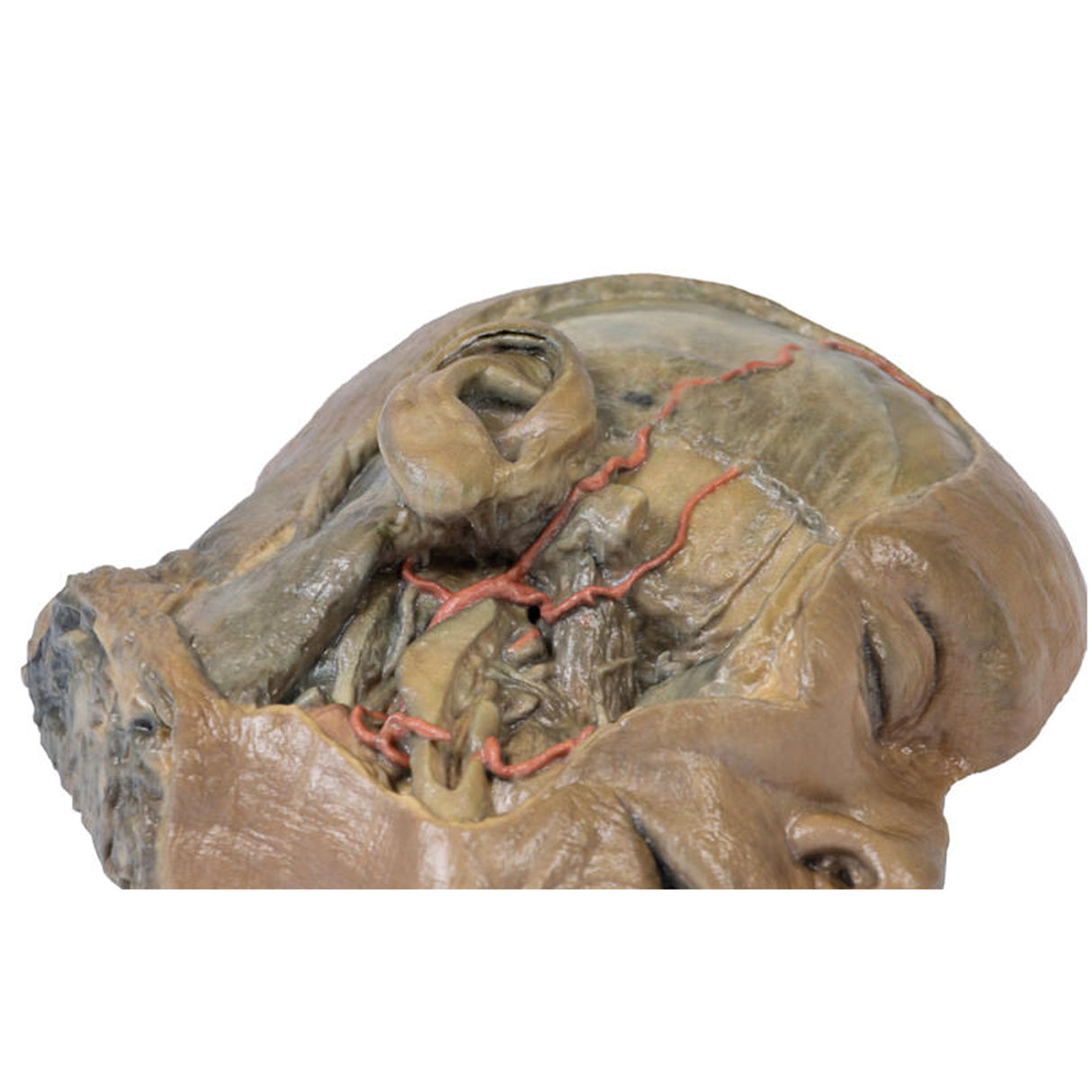Sagittal Section of head with infratemporal Fossa Dissection | EZ-MP1104 | SIm & Skills Ltd