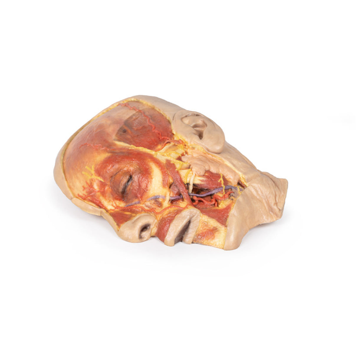 Superficial Face | EZ-MP1108 | Sim & Skills Ltd