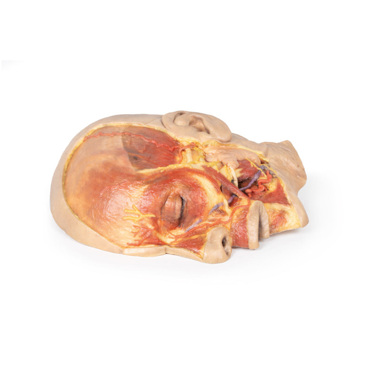 Superficial Face | EZ-MP1108 | Sim & Skills Ltd