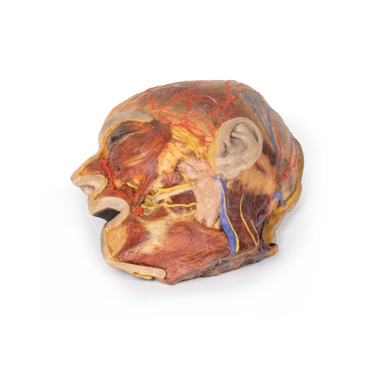 Superficial Facial nerves & Parotid Gland | EZ-MP1109 | Sim & Skills Ltd