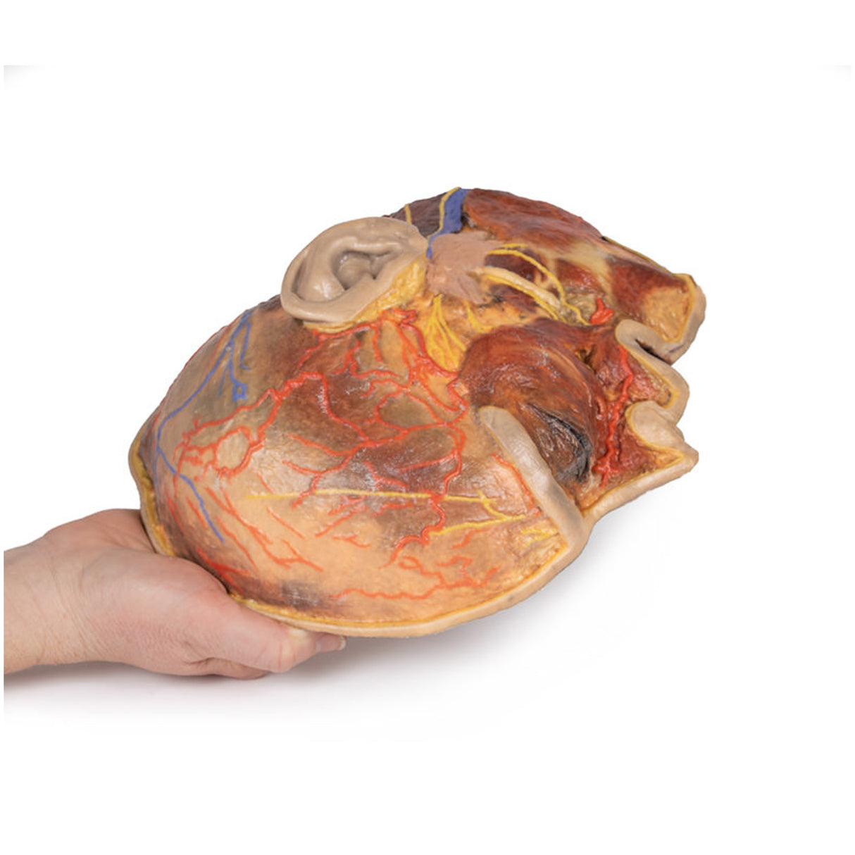 Superficial Facial nerves & Parotid Gland | EZ-MP1109 | Sim & Skills Ltd