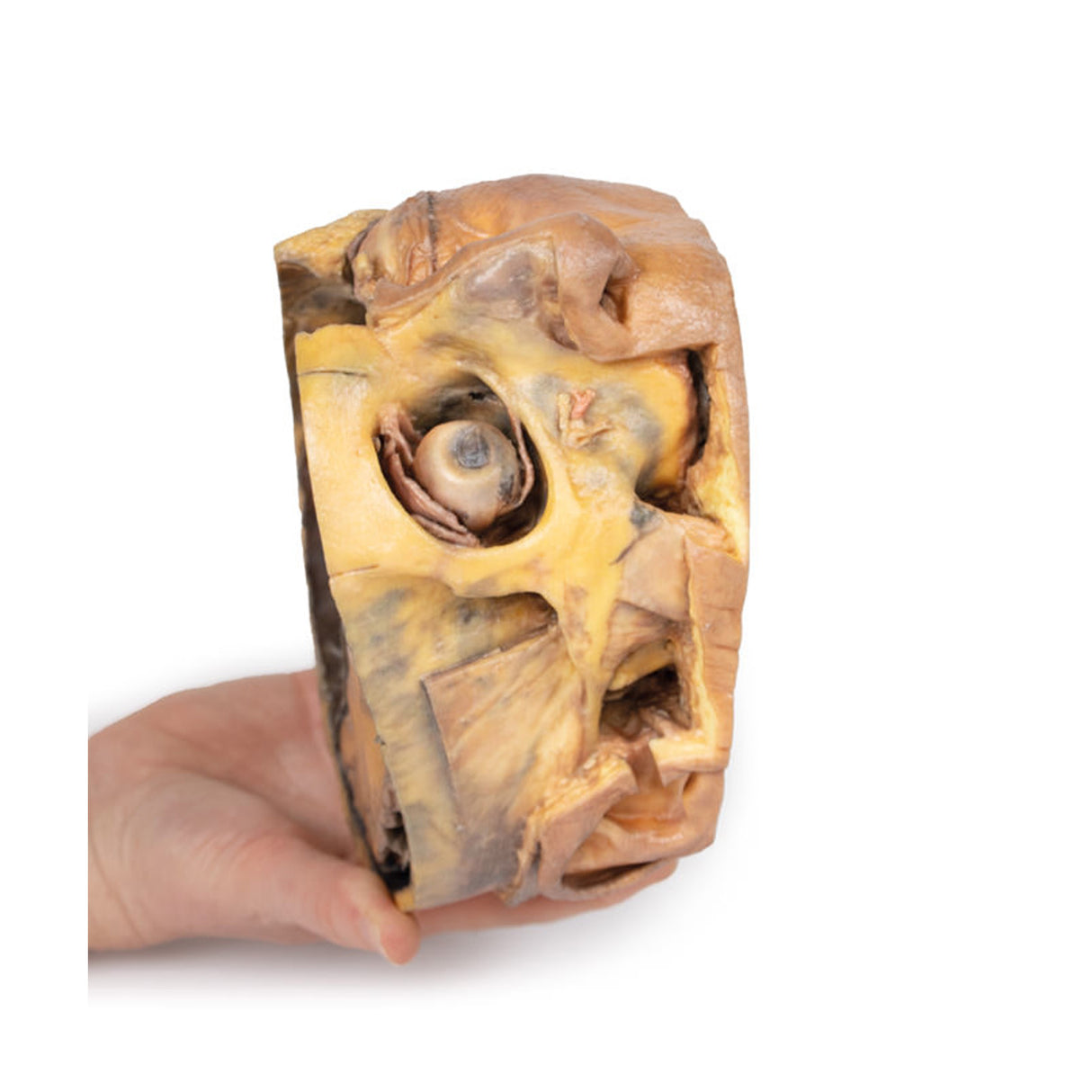 Transverse Section of the head |x EZ-MP1110 | Sim & Skills Ltd