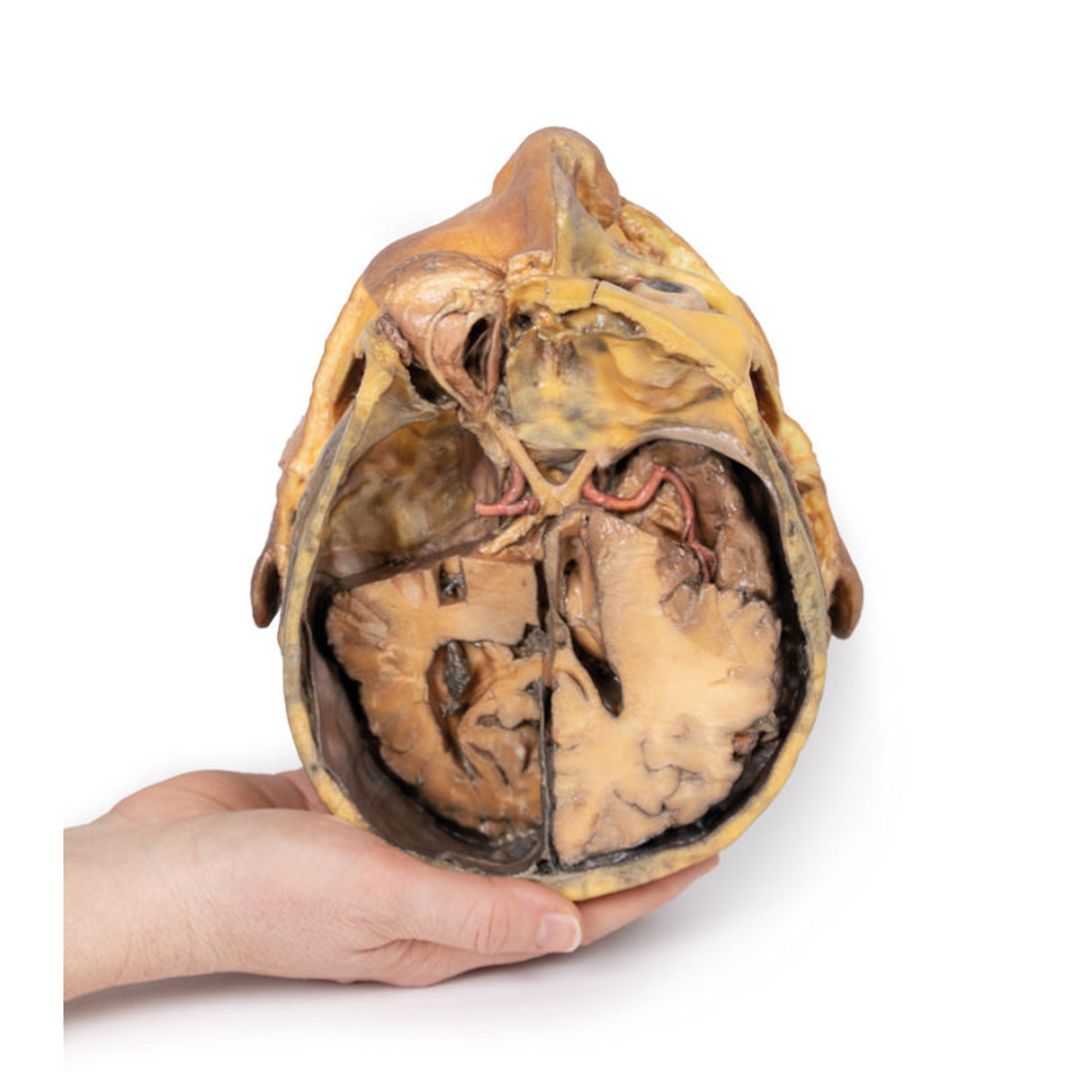 Transverse Section of the head |x EZ-MP1110 | Sim & Skills Ltd