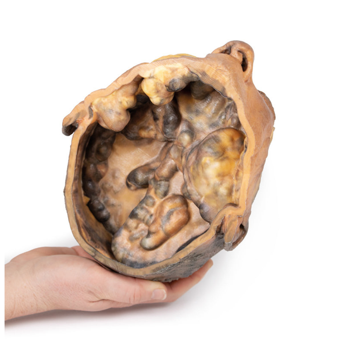Transverse Section of the head |x EZ-MP1110 | Sim & Skills Ltd