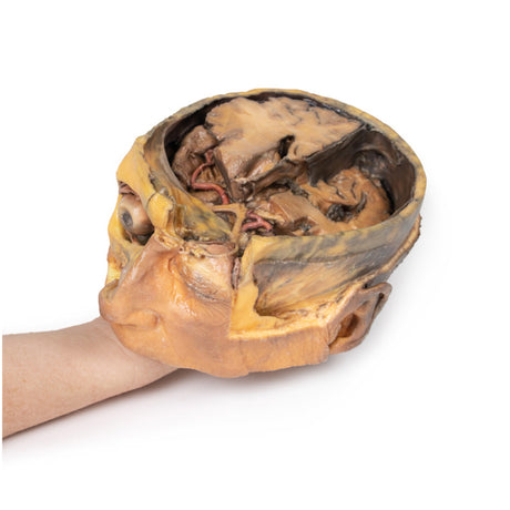 Transverse Section of the head |x EZ-MP1110 | Sim & Skills Ltd