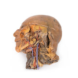 Sagittal Section of Head and Neck with Infratemporal Fossa and Carotid Sheath Dissection | EZ-MP1111 | Sim & Skills Ltd