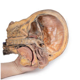 Sagittal Section of Head and Neck with Infratemporal Fossa and Carotid Sheath Dissection | EZ-MP1111 | Sim & Skills Ltd