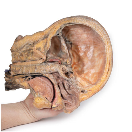 Sagittal Section of Head and Neck with Infratemporal Fossa and Carotid Sheath Dissection | EZ-MP1111 | Sim & Skills Ltd