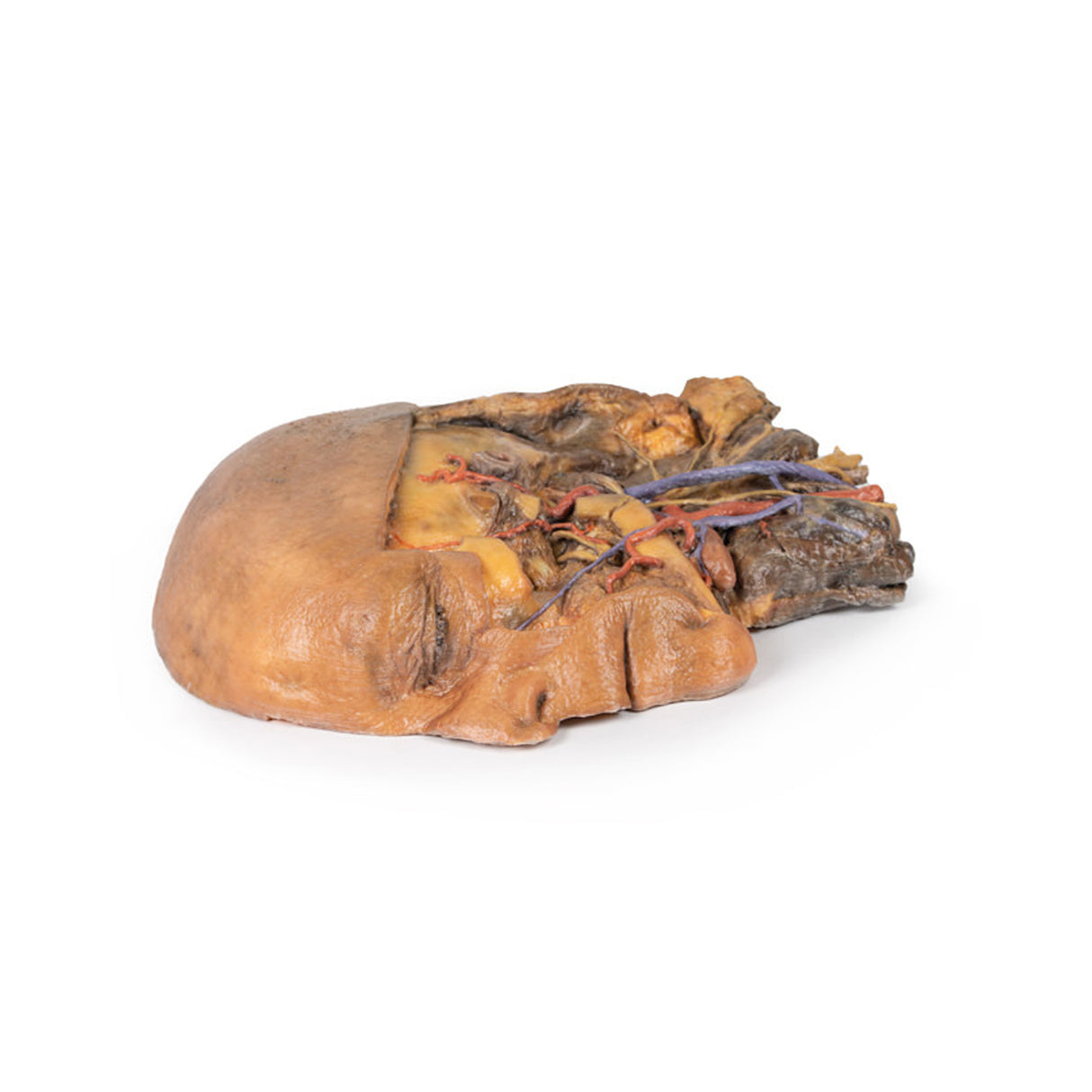 Sagittal Section of Head and Neck with Infratemporal Fossa and Carotid Sheath Dissection | EZ-MP1111 | Sim & Skills Ltd