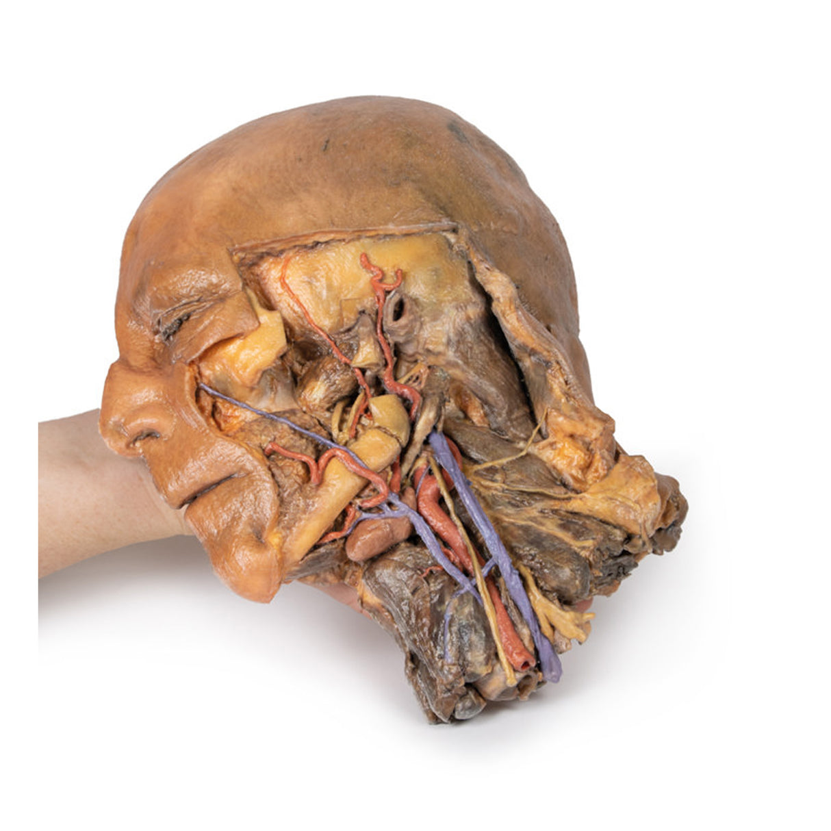 Sagittal Section of Head and Neck with Infratemporal Fossa and Carotid Sheath Dissection | EZ-MP1111 | Sim & Skills Ltd