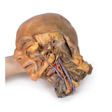 Sagittal Section of Head and Neck with Infratemporal Fossa and Carotid Sheath Dissection | EZ-MP1111 | Sim & Skills Ltd