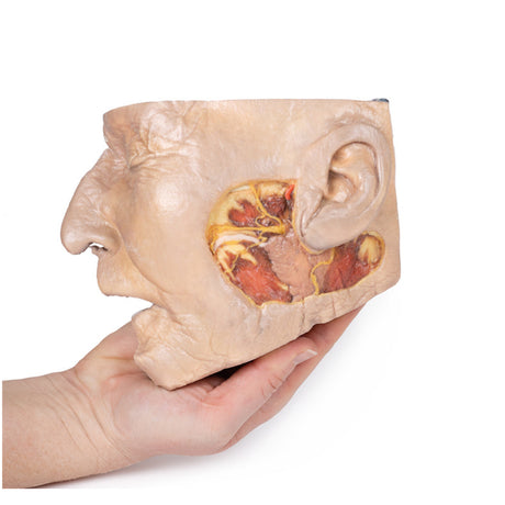 Parotid Gland and Facial Nerve dissection | EZ-MP1112 | Sim & Skills Ltd