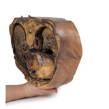 Thoracic cross section at T6 | EZ-MP1120 | Sim & Skills Ltd