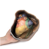 Pericardial space | EZ-MP1121 | Sim & Skills Ltd