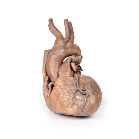 Heart | EZ-MP1123 | Sim & Skills Ltd