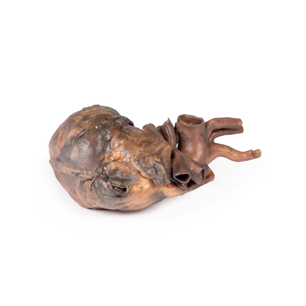 Heart | EZ-MP1123 | Sim & Skills Ltd