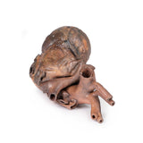 Heart | EZ-MP1123 | Sim & Skills Ltd