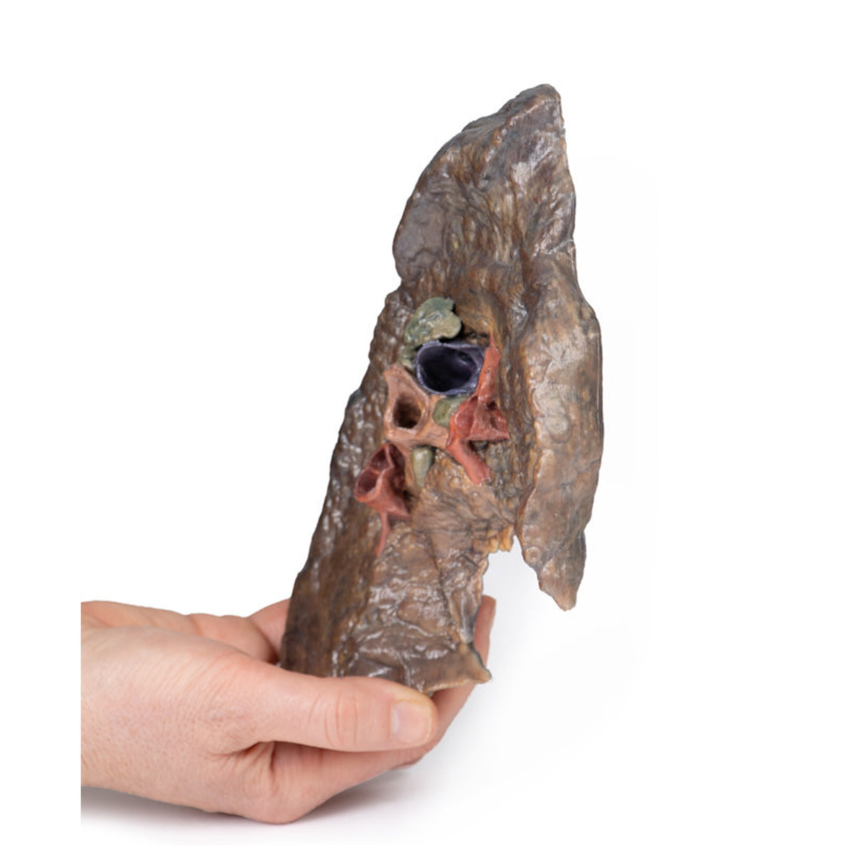 Hilum of the left lung | EZ-MP1124 | Sim & Skills Ltd
