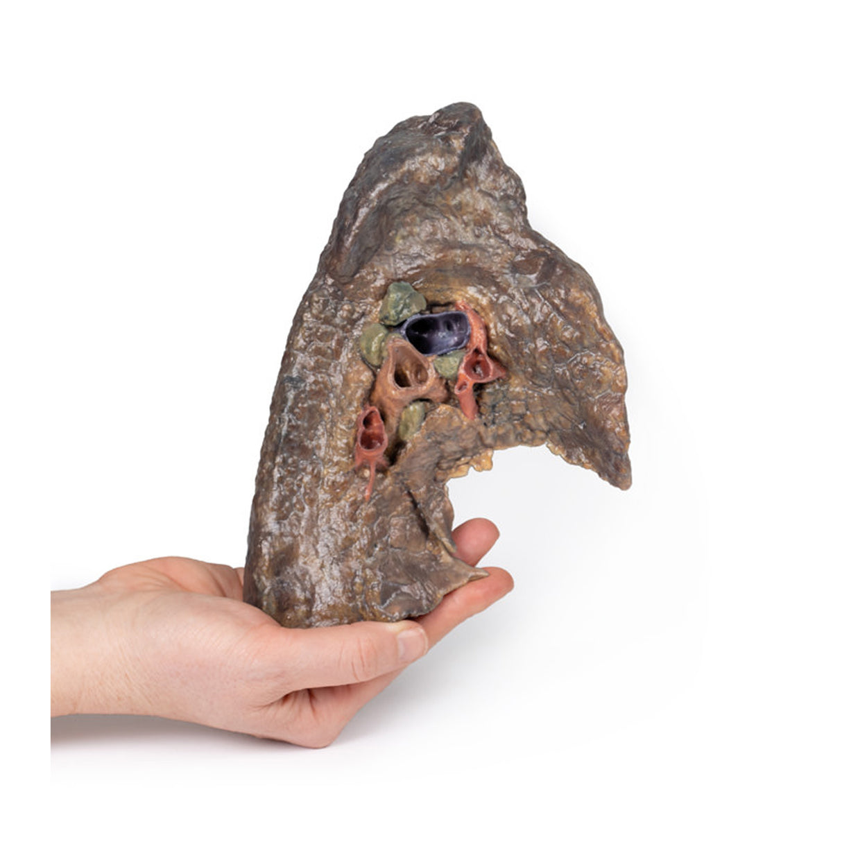Hilum of the left lung | EZ-MP1124 | Sim & Skills Ltd
