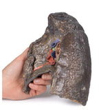 Hilum of the right lung | EZ-MP1127 | Sim & Skills Ltd