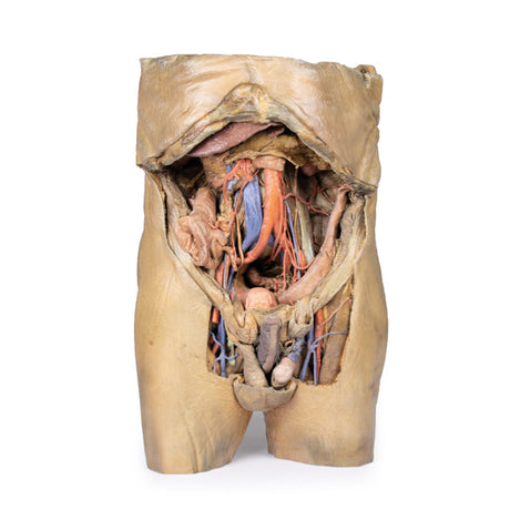 Abdomen with bilateral Hernias | EZ-MP1130 | Sim & Skills Ltd