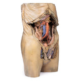 Abdomen with bilateral Hernias | EZ-MP1130 | Sim & Skills Ltd