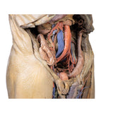 Abdomen with bilateral Hernias | EZ-MP1130 | Sim & Skills Ltd