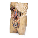 Abdomen with bilateral Hernias | EZ-MP1130 | Sim & Skills Ltd