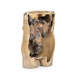 Abdomen with bilateral Hernias | EZ-MP1130 | Sim & Skills Ltd