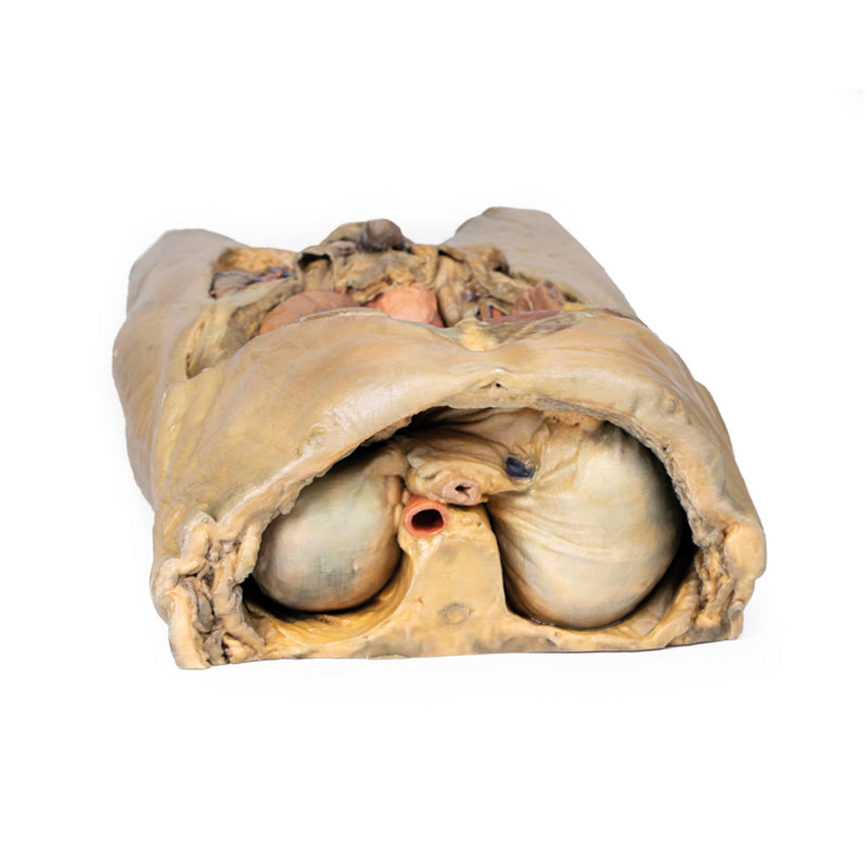 Abdomen with bilateral Hernias | EZ-MP1130 | Sim & Skills Ltd