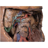 Abdomen vasculature | EZ-MP1131 | Sim & Skills Ltd