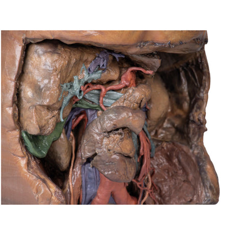 Abdomen vasculature | EZ-MP1131 | Sim & Skills Ltd