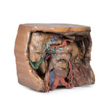 Abdomen vasculature | EZ-MP1131 | Sim & Skills Ltd