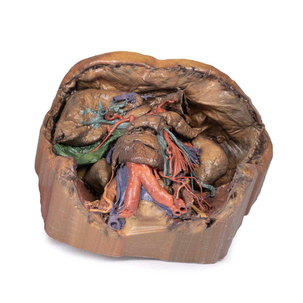 Abdomen vasculature | EZ-MP1131 | Sim & Skills Ltd