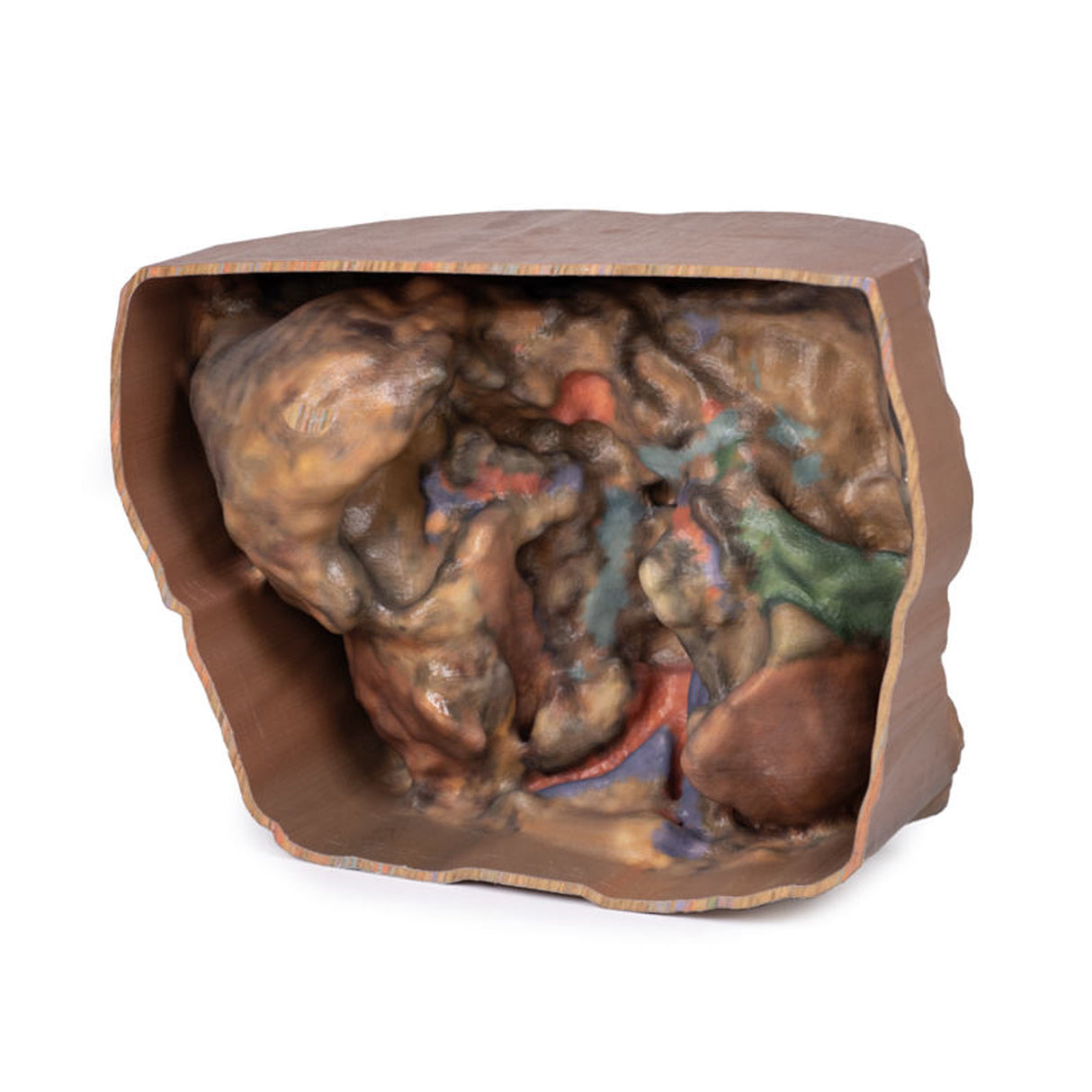 Abdomen vasculature | EZ-MP1131 | Sim & Skills Ltd
