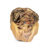 Abdomen with inguinal hernia | EZ-MP1133 | Sim & Skills Ltd