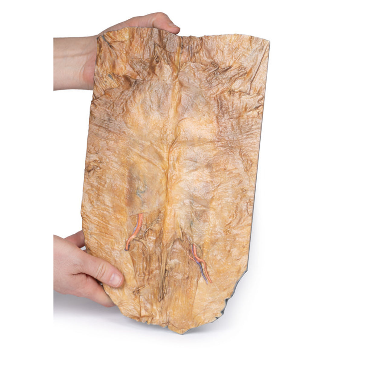 Internal abdominal wall | EZ-MP1137 | Sim & Skills Ltd